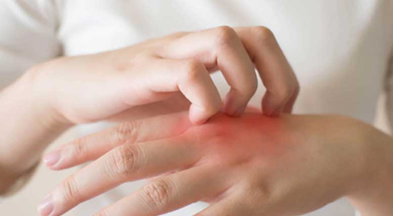 Dr. Yeung Ho Hong(楊浩康) explains tinea corporis