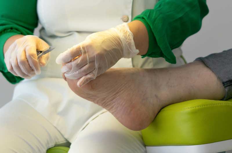 Dr. Yeung Ho Hong(楊浩康) explains Paronychia